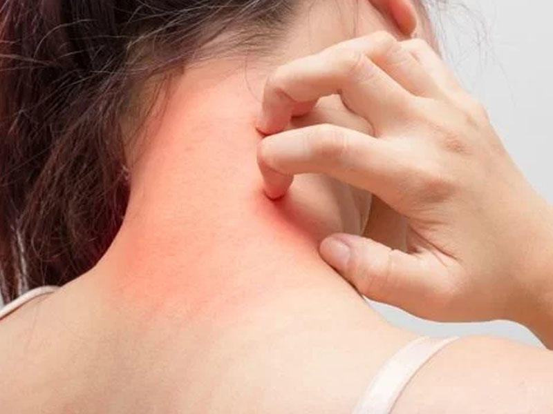 Gizli xəstəlik sürətlə yayılır: 12 nəfər öldü