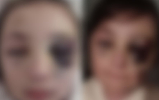 DİN-dən döyüldüyü deyilən şagirdlə bağlı RƏSMİ AÇIQLAMA - FOTO