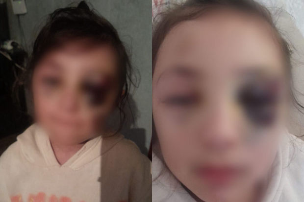 Bakıda şagirdin xəsarət almasına görə müəllimə töhmət verildi