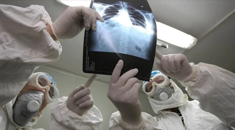 İngiltərədə yeni virus növü aşkarlandı