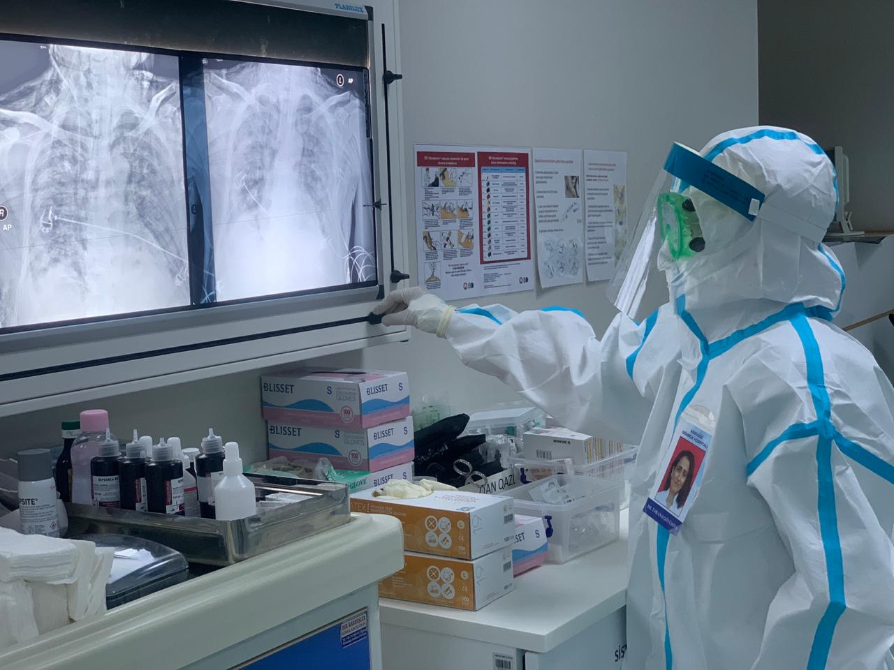 Azərbaycanda son həftədə 17 nəfər koronavirusa yoluxdu