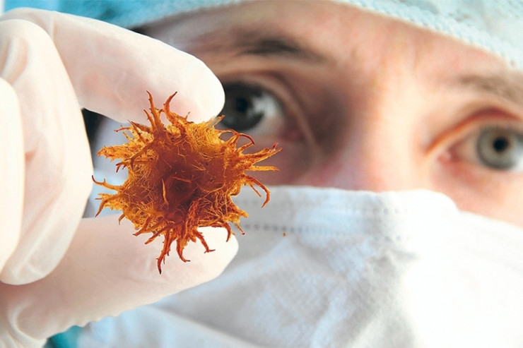 Azərbaycanda yoluxucu xəstəliklərlə bağlı HƏYƏCAN TƏBİLİ ÇALINDI