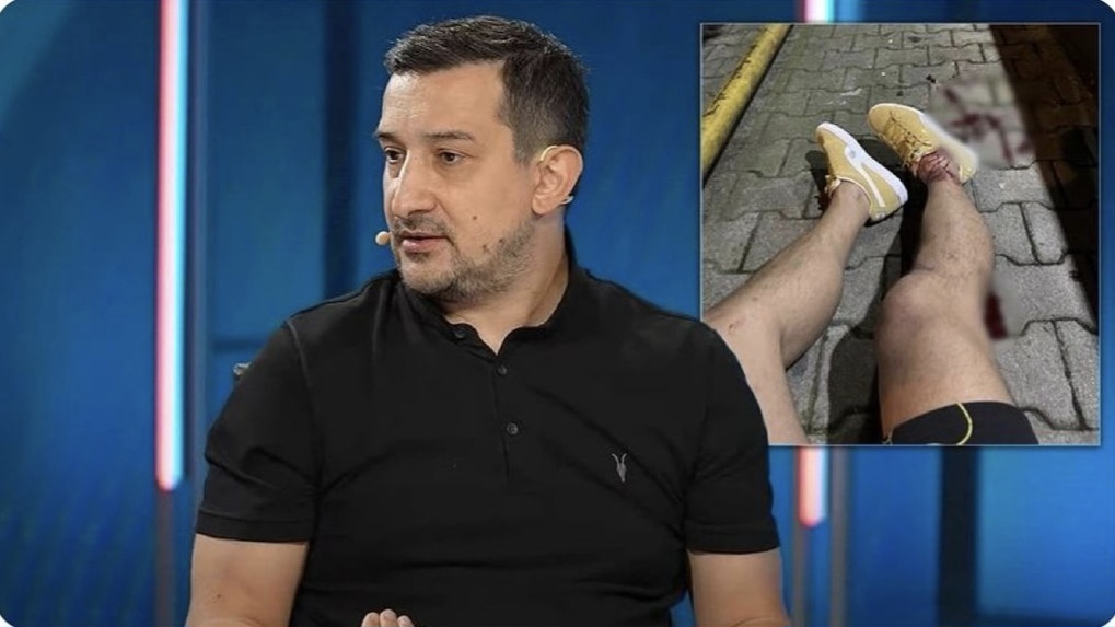 Ali Koçu tənqid edən keçmiş futbolçuya silahlı hücum oldu