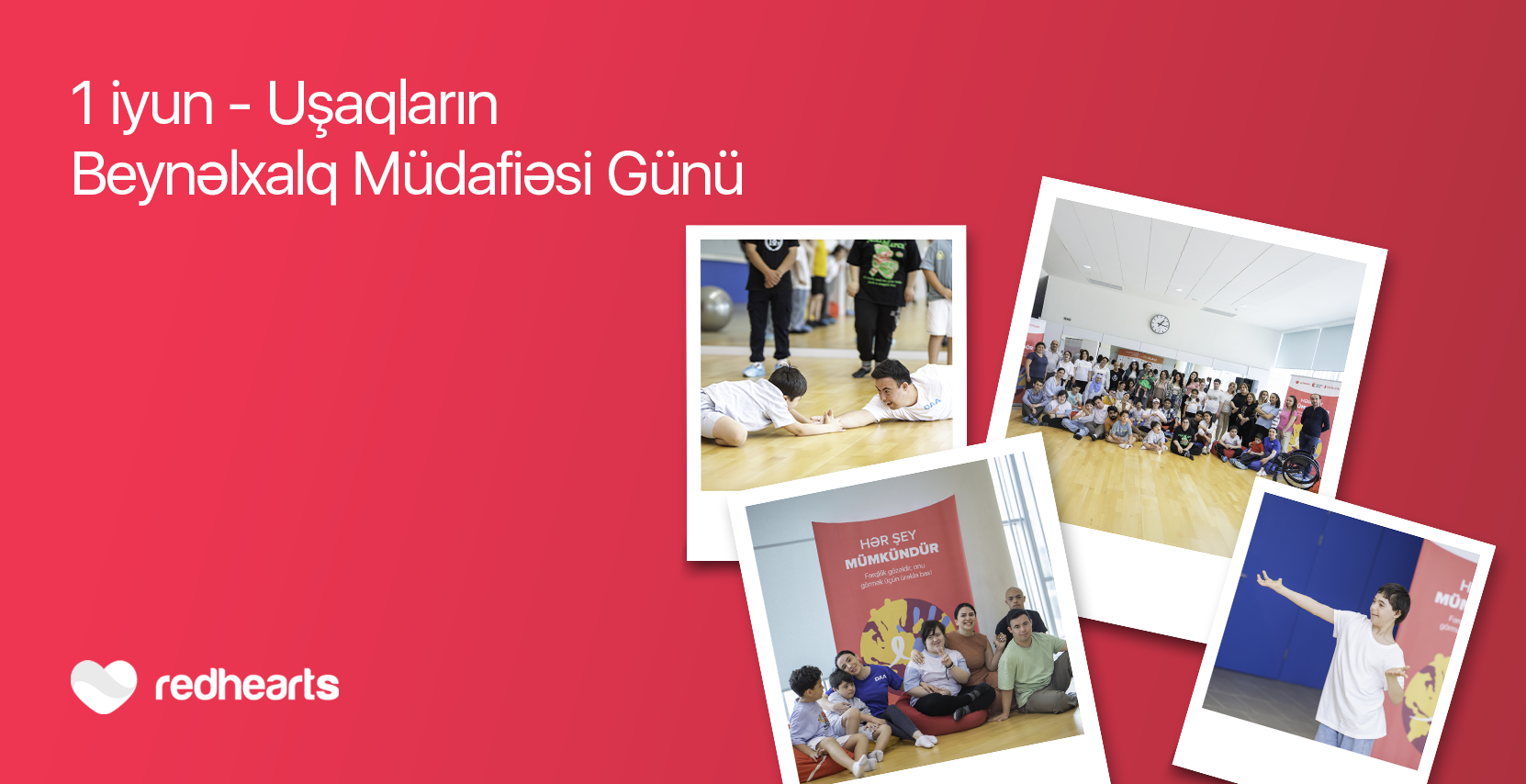 Hər şey mümkündür: Daun sindromlu uşaqlar üçün sosial layihə