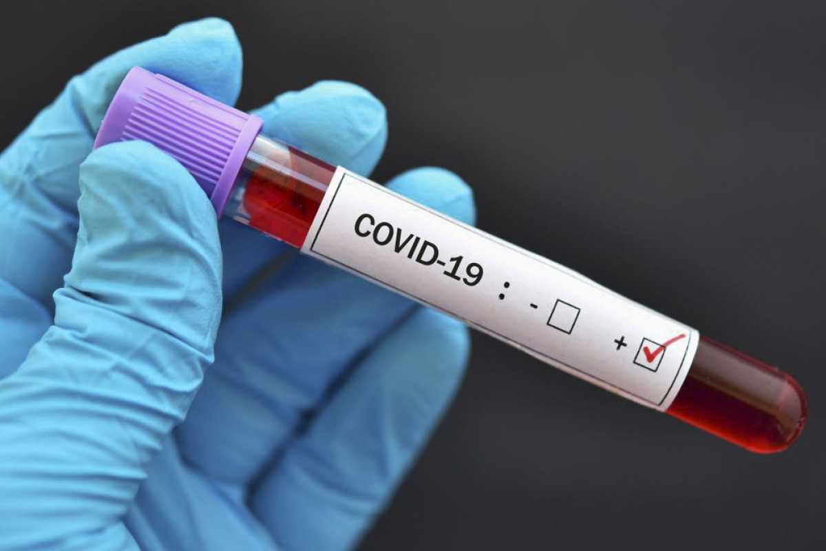 Növbəti koronavirus pandemiyasına yol aça biləcək virus aşkarlanıb