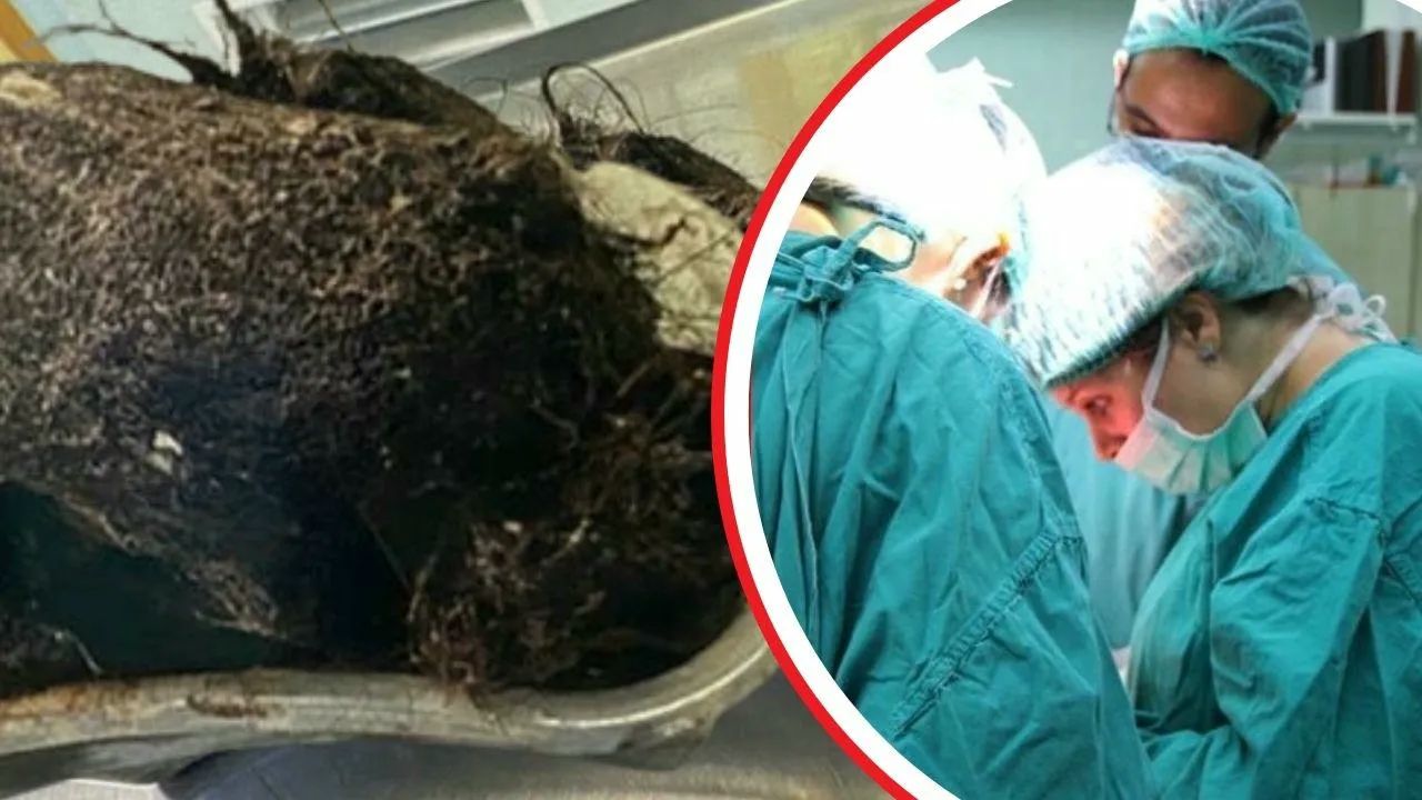 14 yaşlı qız qarın ağrısı ilə həkimə müraciət etdi - Mədəsindən çıxanlar həkimləri şoka saldı