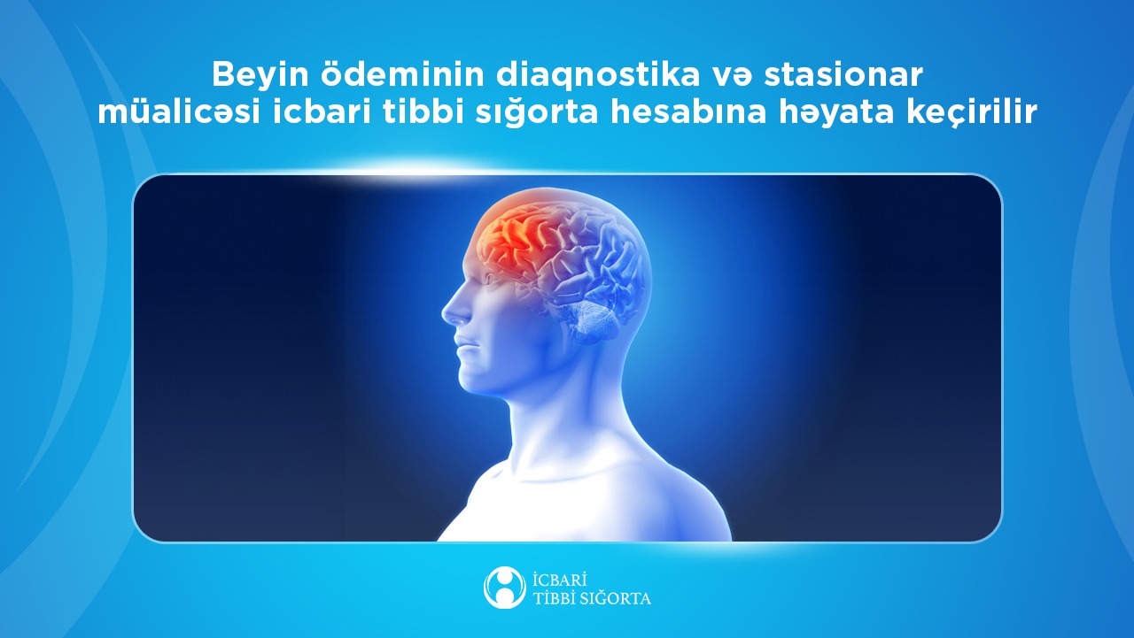 Beyin ödeminin müalicəsi icbari tibbi sığorta hesabına həyata keçirilir
