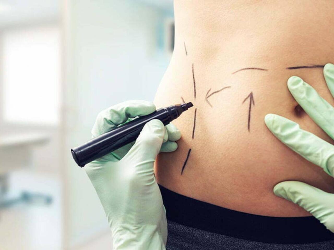 Sevgilisinin 140 min dollarını gizlicə estetik əməliyyatlara xərclədi