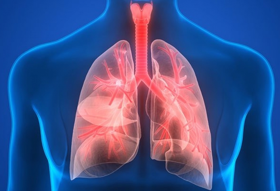 Həkimlərdən xəbərdarlıq: pnevmoniya vaxtında müalicə olunmasa…