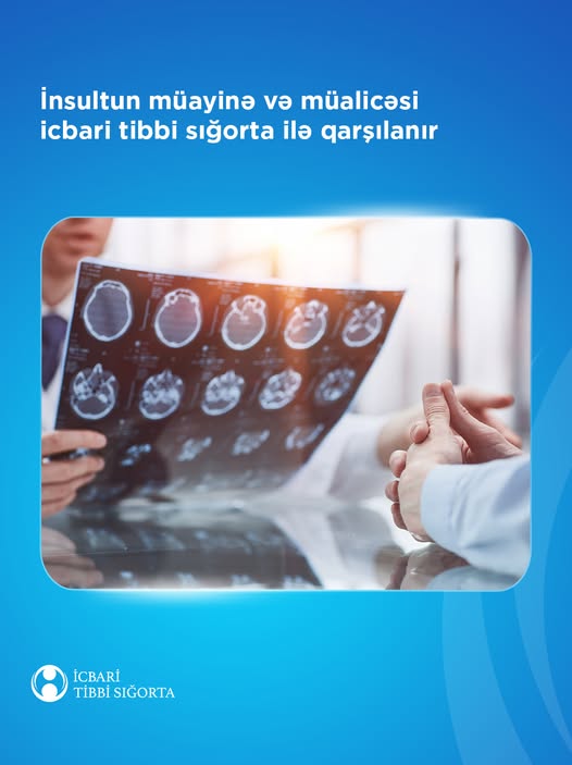 İnsultun müayinə və müalicəsi icbari tibbi sığorta ilə qarşılanır