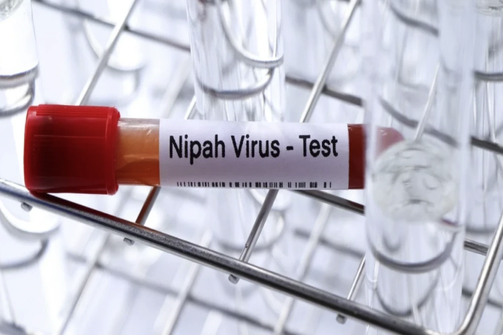 ÜST: Hindistanda Nipah virusunun yayılma riski azdır
