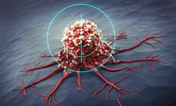 Stressin xərçəngə səbəb olduğu isbat olundu