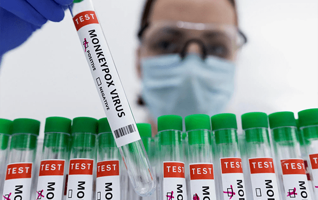 Rusiyada meymunçiçəyi virusuna yeni yoluxma qeydə alınıb