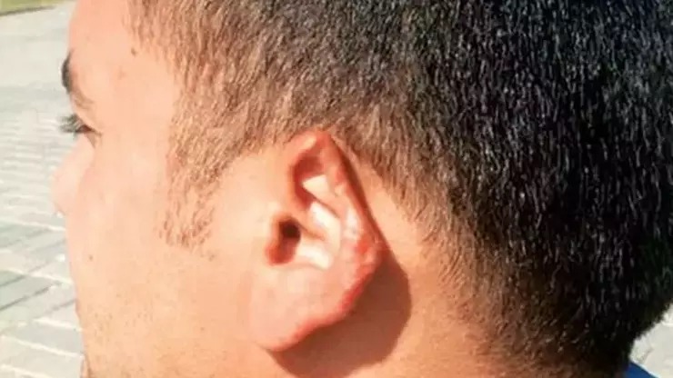 Əri ilə dalaşan qadın onun qulağını qopardı