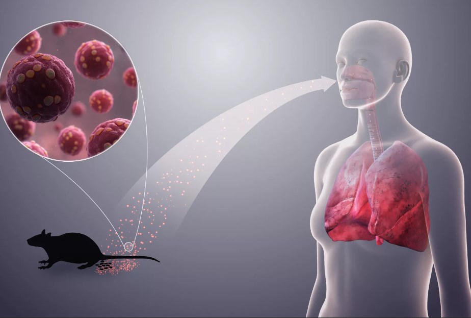 “Hantavirus” yoluxucudur? - ÜST-dən açıqlama