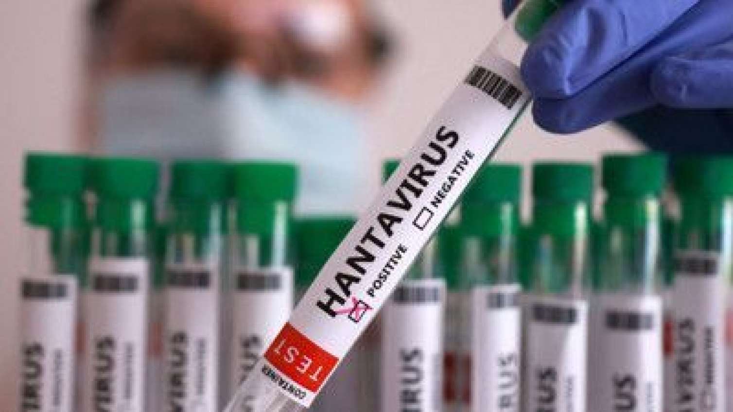 Evdə hantavirusu belə yoxlamaq olur
