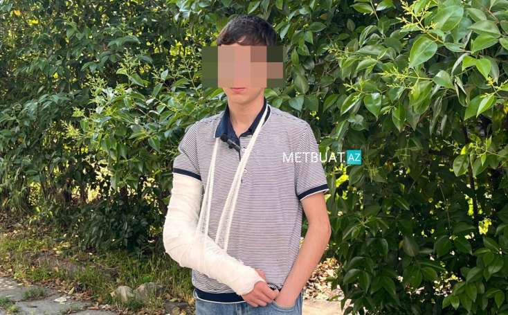 17 yaşlı şagirdin qolunu müəllimi sındırıb?