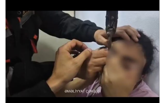 Sabunçuda göz qapağı paltar zəncirbəndinə ilişən qadın xilas edildi - VİDEO