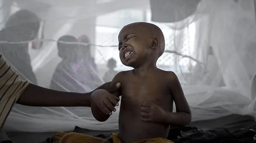 Nigeriyada vəba epidemiyası: 14 nəfər öldü