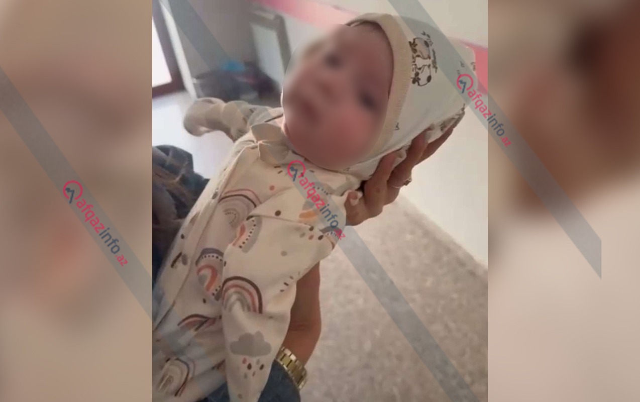 Ananın qolları olmayan körpəsindən imtina etməsi ilə bağlı - Rəsmi açıqlama