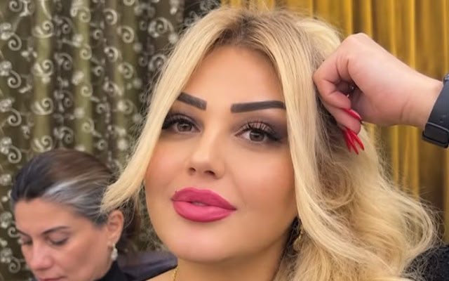 Bakıda dişi çəkilən qadın öldü - VİDEO