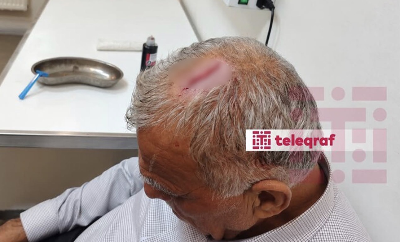 İcra nümayəndəsi bələdiyyə sədrinin başına butulka çırpdı